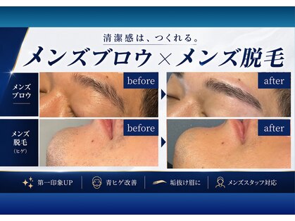 ノビシロホワイトニング(nobi-SHIROホワイトニング)の写真