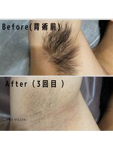 パーミル 楠葉店(per mille‰)/Before/After