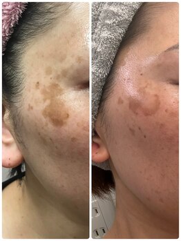 メディカルサロン アヴェニール(Avenir)/私の人生を変えてくれているもの