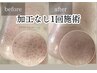 長年の黒ずみ毛穴撃退！毛穴レスフェイシャル初回体験8,900円