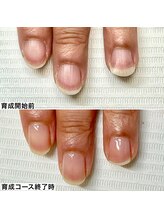 ベッレ マーニ/桃色美爪育成コース