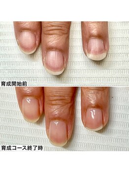 ベッレ マーニ/桃色美爪育成コース