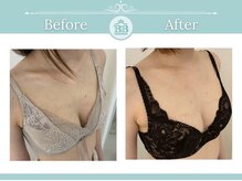 美人バスト 掛川店/【バストアップ/育乳静岡/掛川】