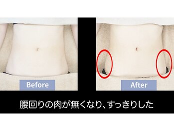 ローブメール(Robemail)/腰回りの肉がなくなり、スッキリ