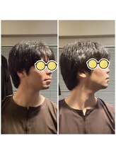 エクステンド鍼灸整体院(extend鍼灸整体院)/施術後　鍼