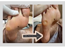 フットタイムズ(FOOT TIMES)の雰囲気(魚の目もお任せください.)