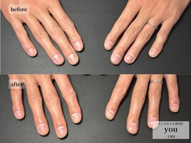 ネイルケア