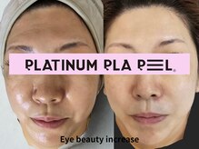 アイ ビューティー インクリース 岸和田店(Eye beauty increase)/プラピール★