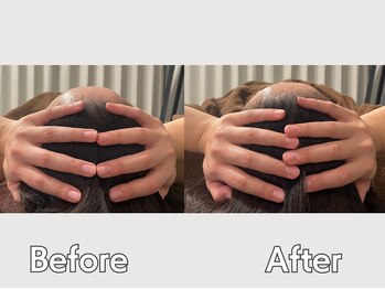 ゲントツ 新宿/小顔　小顔矯正