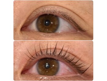 プローサム(Prorsum)