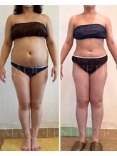 マクイエステティック 表参道店&nbsp;ビフォー アフター