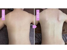 ブリス 渋谷駅前(BliSS)/1回で動く！肩甲骨ライン革命！