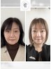 頭、顔、デコルテ、腕の4点セットで小顔美人に♪¥16,500