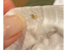 サイ(Sai)/before⇒after