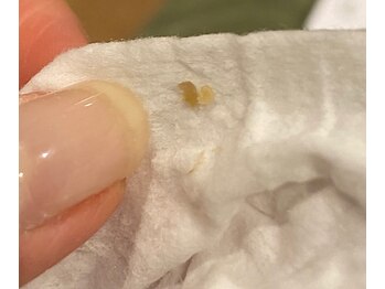 サイ(Sai)/before⇒after