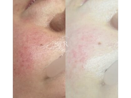 ルピナス ロッポンギ(Rupinus ROPPONGI)の写真