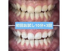 プラチナムビューティー 名古屋栄本店(PLATINUM BEAUTY)/【Before⇒After】