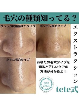 ティアラ(TIARA)/tete式毛穴エクストラクション