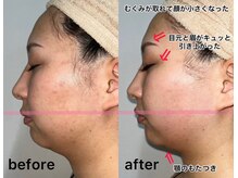 クリア アイラッシーズ アンド ネイルサロン シャイン(CLEAR & SHINE)/