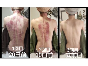 オアシス(OASIS)/ホット★カッサ