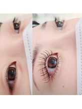 コア(Koa)/さらに可愛い目元にしませんか？