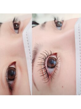 コア(Koa)/さらに可愛い目元にしませんか?