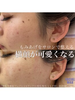 エリス(ELISSE)/横顔が可愛くなるサロンケア