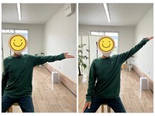 すまいむ整体院/肩の可動域改善