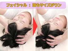 江坂回復アップラボ/フェイシャル：頭もサイズダウン