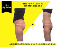 イエス マイサロン(yes My Salon)/自動筋トレマシンBIJIRIS施術例