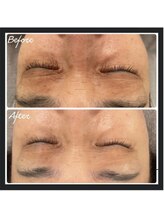 サロンドジョリー/目回りの色、シワ改善！！