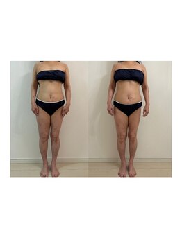 セメ(S'aimer)/インド式デトックスリンパ