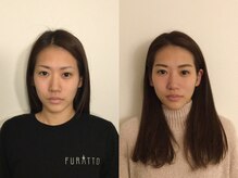 フラット(FURATTO)/Before - After【施術約10回】