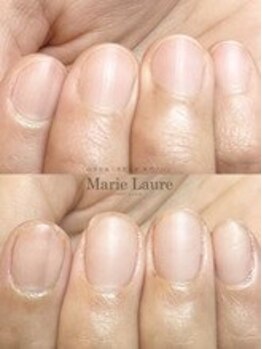 マリーロール 梅田店(Marie Laure)/自爪育成/深爪矯正/ネイルケア