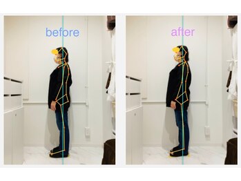 レピア 夙川本店(Lepia)/ビフォーアフターのご紹介♪