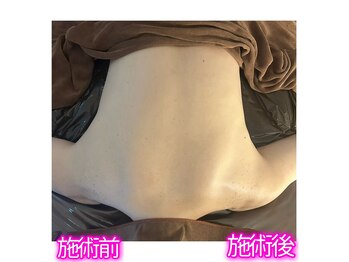 リオラ ビューティー(Liora beauty)/《before/after》