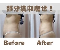 痩身 脱毛専門サロン 椿