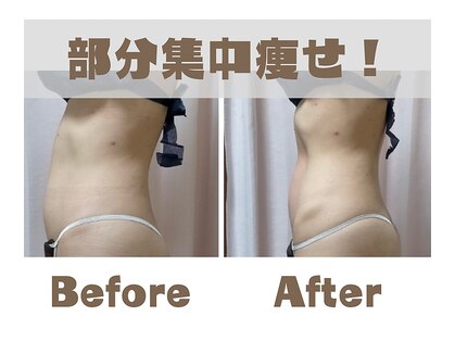 痩身 脱毛専門サロン 椿の写真