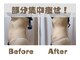 痩身 脱毛専門サロン 椿の写真