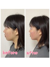 小顔整体 優/横から見ても小顔になれる！