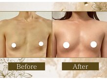 マリン(MARINE)/Before/After