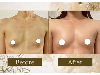 マリン(MARINE)/Before/After