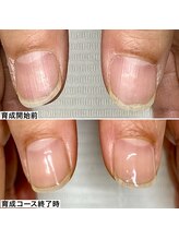 ベッレ マーニ/桃色美爪育成コース