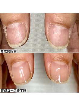 ベッレ マーニ/桃色美爪育成コース