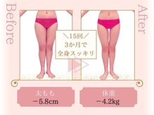 ピュアエステ ブリアント 松戸店/お客様の結果［松戸/痩身］