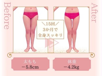 ピュアエステ ブリアント 松戸店/お客様の結果［松戸/痩身］