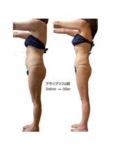 クレビア 神保町 水道橋(CREBIA)/ダイエット/痩身サロン