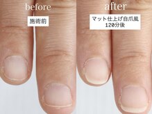 メイシンネイル(Meixingnail)/ツヤ消しの自然な自爪風深爪矯正