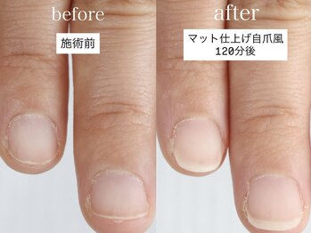 メイシンネイル(Meixingnail)/ツヤ消しの自然な自爪風深爪矯正