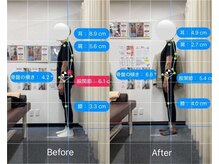 ナオル整体 人形町店(NAORU整体)/姿勢矯正/デスクワーク/肩こり